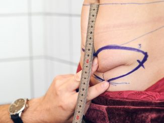 abdominoplastie